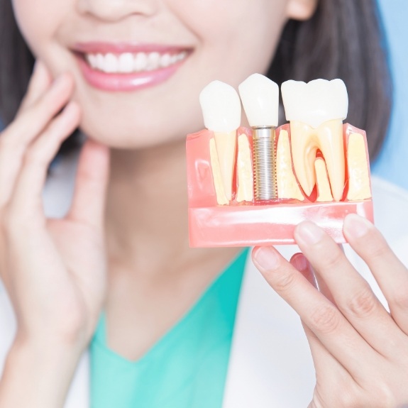 Dentist holding a dental implant model